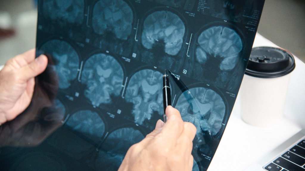 doctor is diagnosing brain problems using x-ray